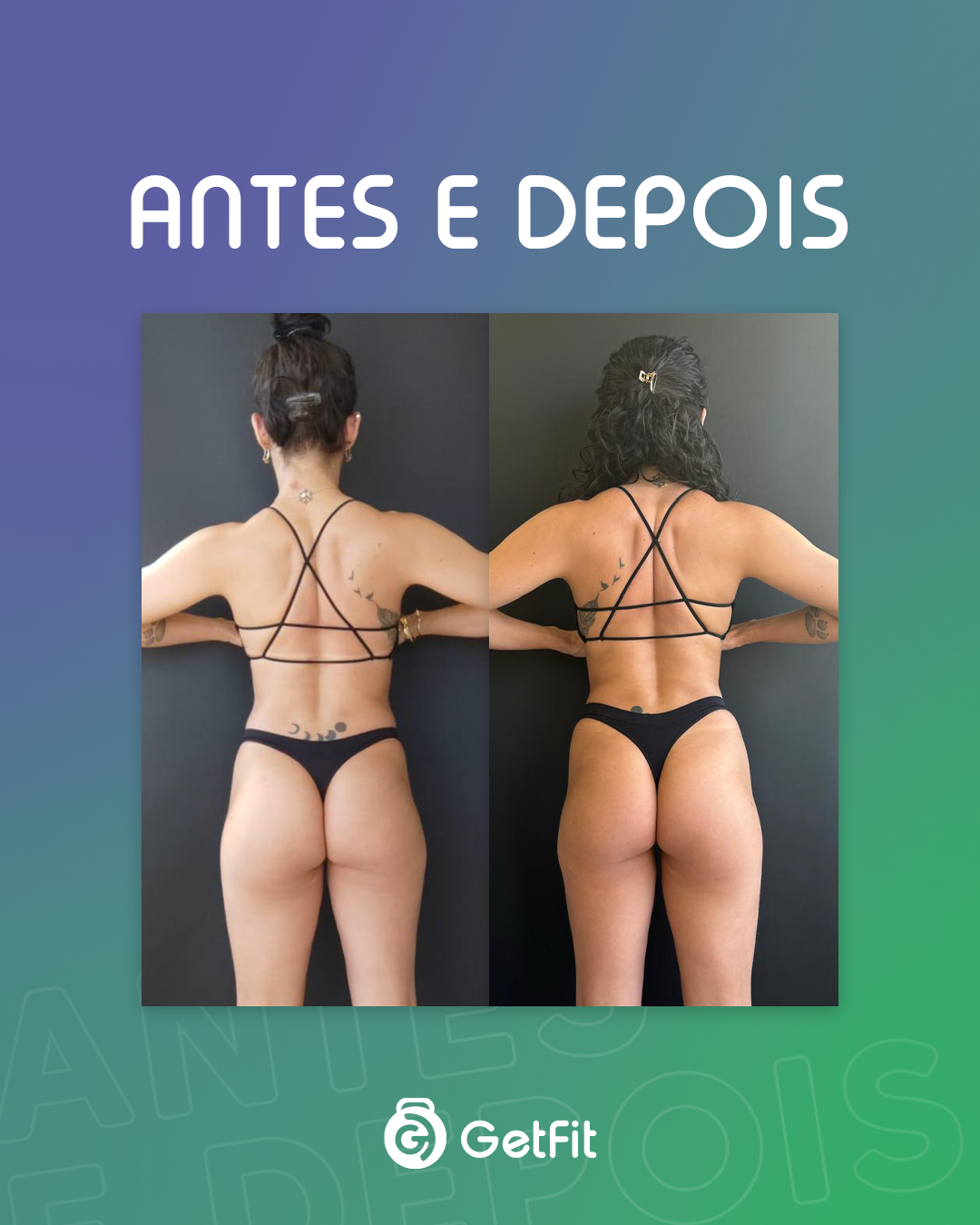 Antes X Depois 04.3