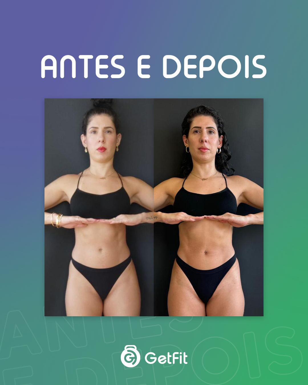 Antes X Depois 04
